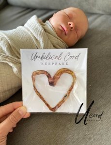 Baby's Umbilical Cord Keepsake Preserved By UCordKeepsakes